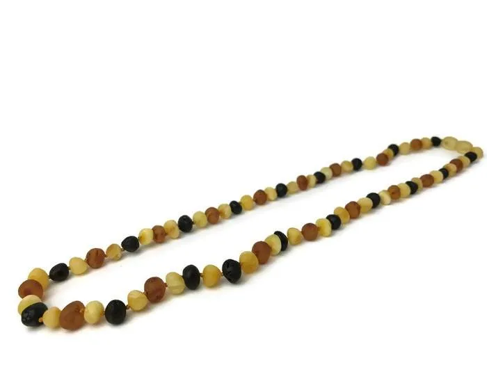 Adult Baltic Amber Arthritis Carpal Tunnel Sciatica Migraine Back Pain Baltic Essentials Earrings