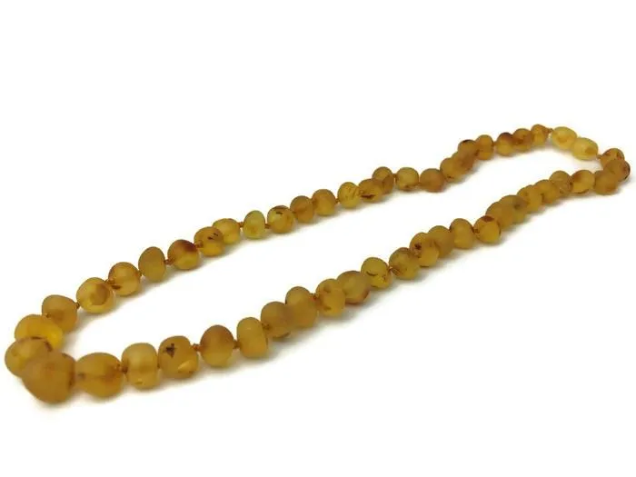 Adult Baltic Amber Arthritis Carpal Tunnel Sciatica Migraine Back Pain Baltic Essentials Earrings