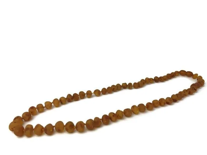 Adult Baltic Amber Arthritis Carpal Tunnel Sciatica Migraine Back Pain Baltic Essentials Earrings
