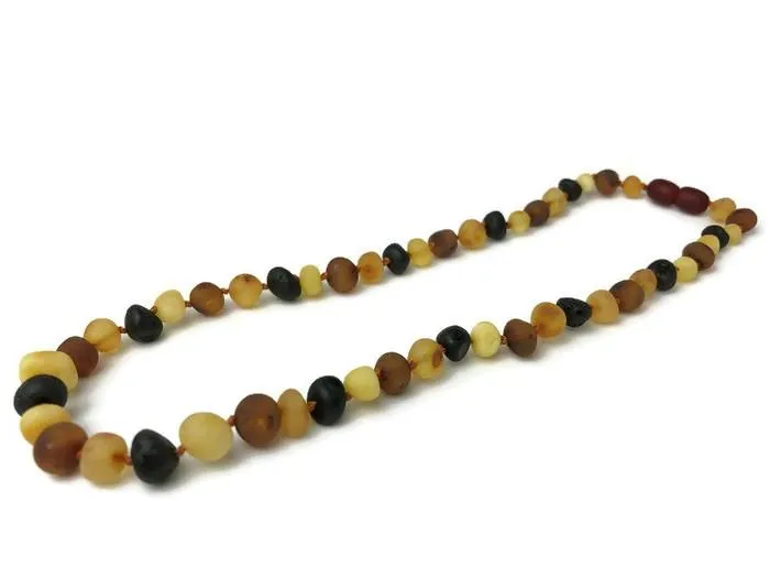 Adult Baltic Amber Arthritis Carpal Tunnel Sciatica Migraine Back Pain Baltic Essentials Earrings